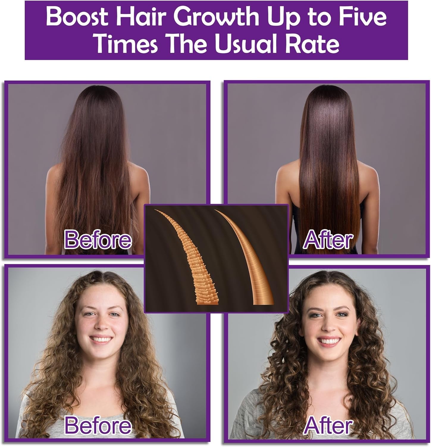 Hair Growth Shampoo and Conditioner Set with Rosemary Oil Serum, Biotin, Argan, Castor, Coconut, Keratin, Rice Water - Hair Loss Treatment, Thickening for Women and Men